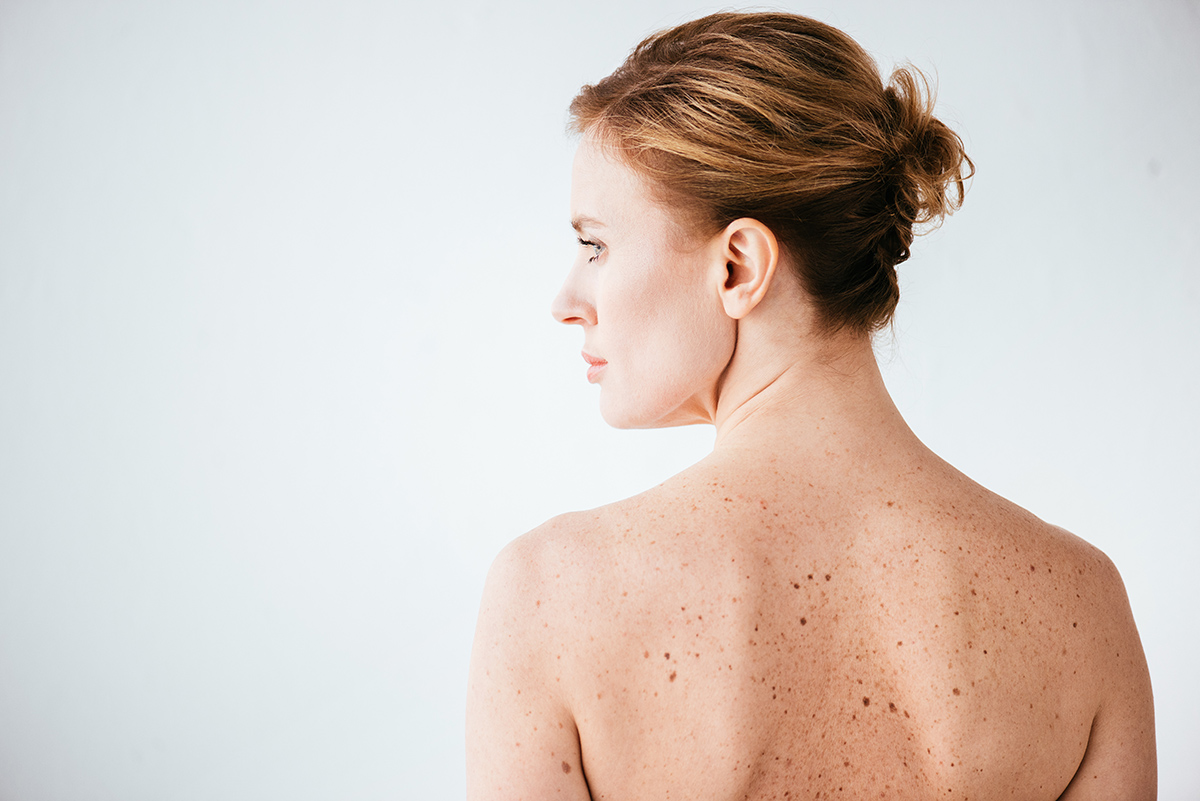 Attractive Woman Skin Sickness